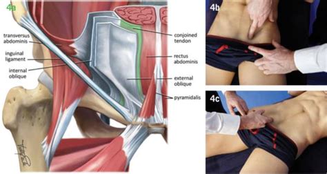 How Vitaros Cream is applied to treat ED