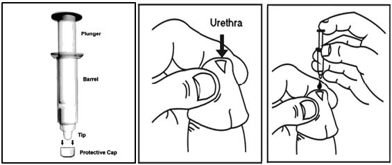 Vitaros Cream FAQs: Everything Men Ask Before and After Using It How to apply Vitaros Cream safely